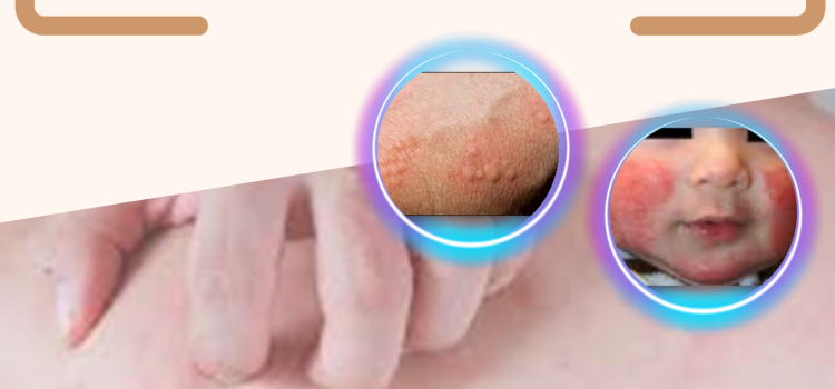 Journée de Formation Médicale Continue : << DERMATO-ALLERGOLOGIE >> le Dimanche 21 Avril 2024 Journée de Formation Médicale Continue : << DERMATO-ALLERGOLOGIE >> le Dimanche 21 Avril 2024