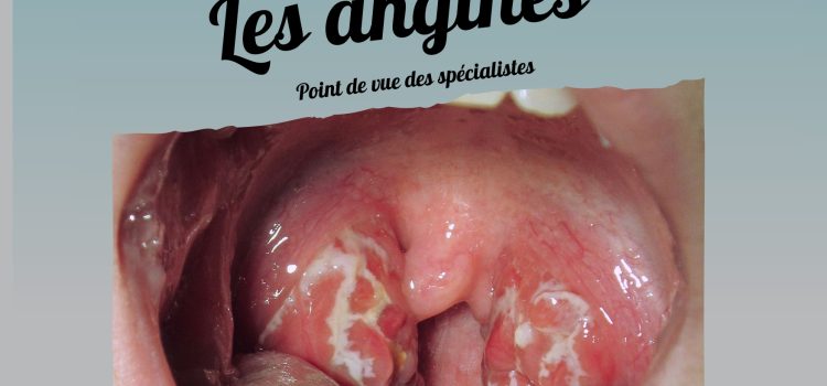 Formation Médicale Continue : Les Angines : Point De Vue Des Spécialistes. Mercredi 08 Janvier 2025 Formation Médicale Continue : Les Angines : Point De Vue Des Spécialistes. Mercredi 08 Janvier 2025