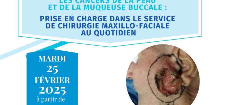 Journée de Formation Médicale en Chirurgie Maxillo-Faciale :       Cancers de la peau et de la muqueuse buccale –           Mardi le 25 février 2025
