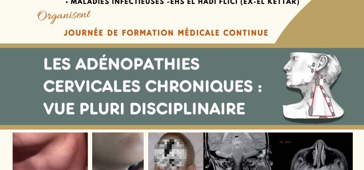 Journée de Formation Médicale Continue: Les adénopathies cervicales chroniques: Vue pluri disciplinaire le Mercredi 22 octobre 2025 Journée de Formation Médicale Continue: Les adénopathies cervicales chroniques: Vue pluri disciplinaire le Mercredi 22 octobre 2025