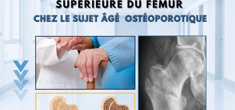 Journée de Formation Médicale continue : les fractures de l’extrémité supérieure du fémur chez le sujet âgé ostéoporotique  le Mercredi 10 Décembre 2025