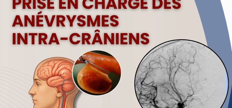 Journée de formation médicale continue : « Prise en charge des anévrysmes intra-crâniens »  – Mardi le 03 février 2026