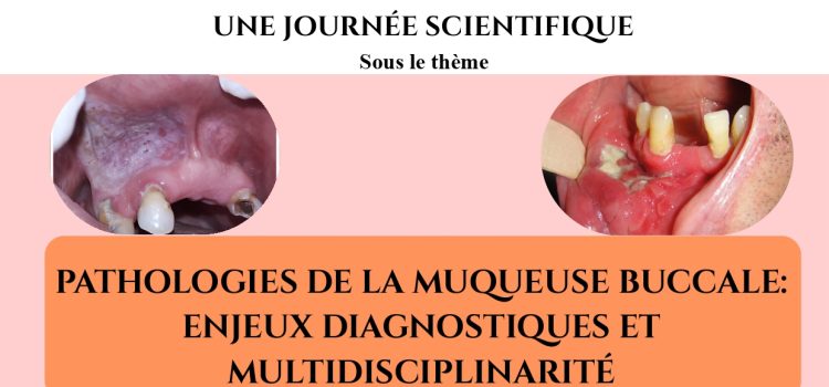 Journée scientifique : Pathologies de la muqueuse buccale: enjeux diagnostiques et multidisciplinarité  – Lundi 04 mai 2026